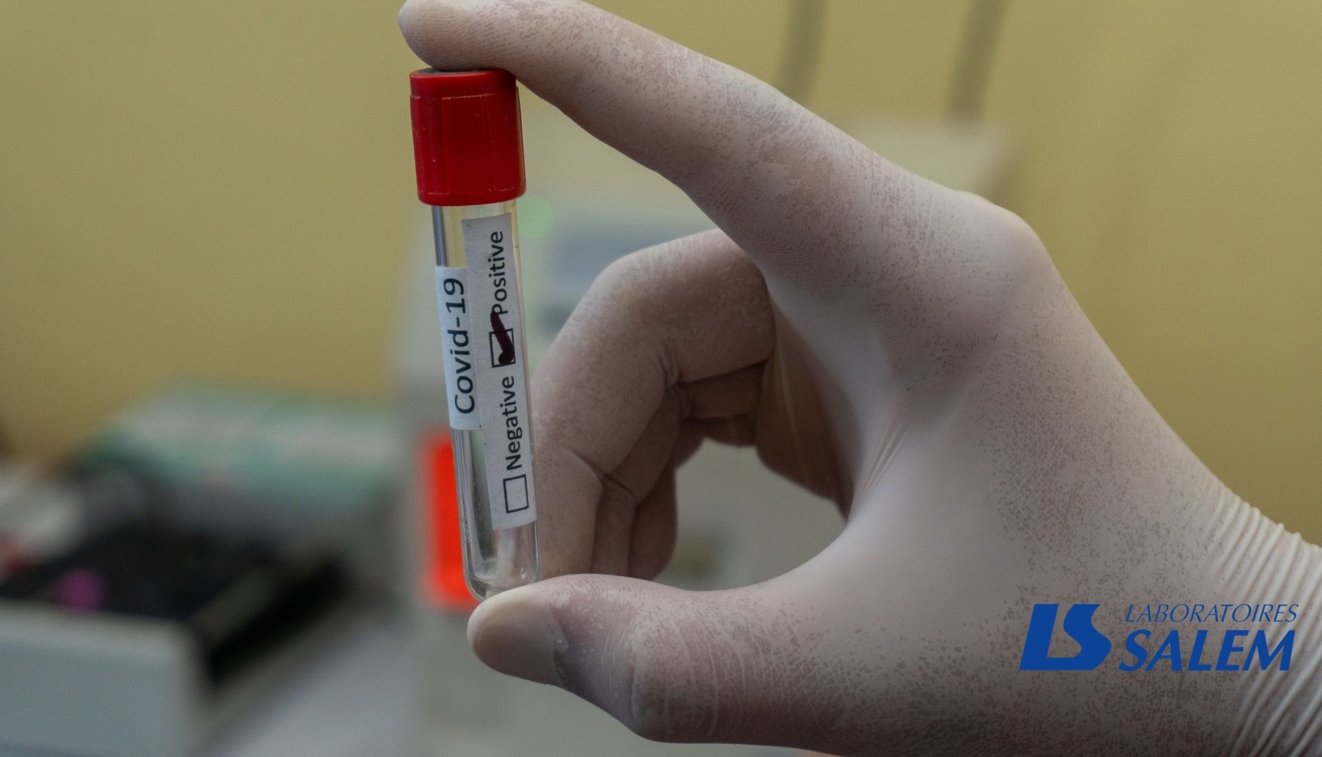 Lire la suite à propos de l’article Dépistage du coronavirus : test virologique, sérologique et antigénique
