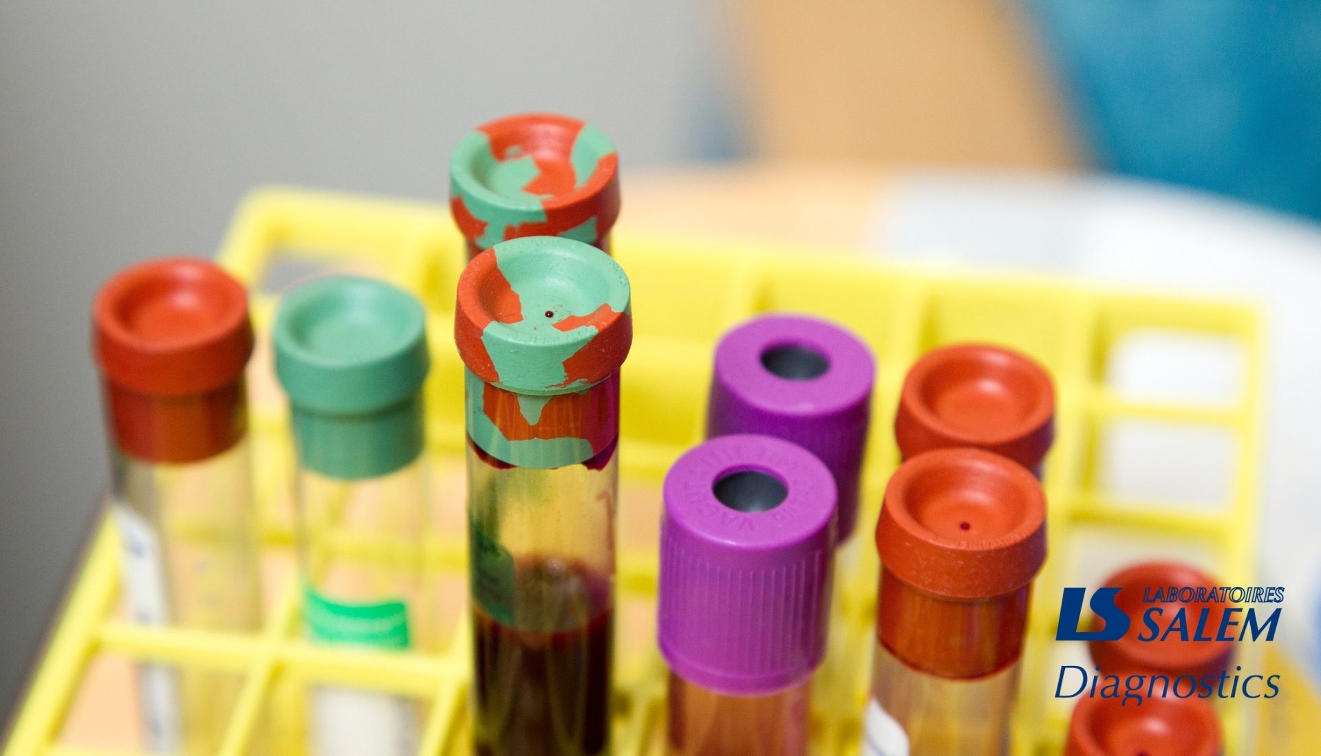 Lire la suite à propos de l’article COVID-19 : les tests sérologiques et moléculaires (PCR)