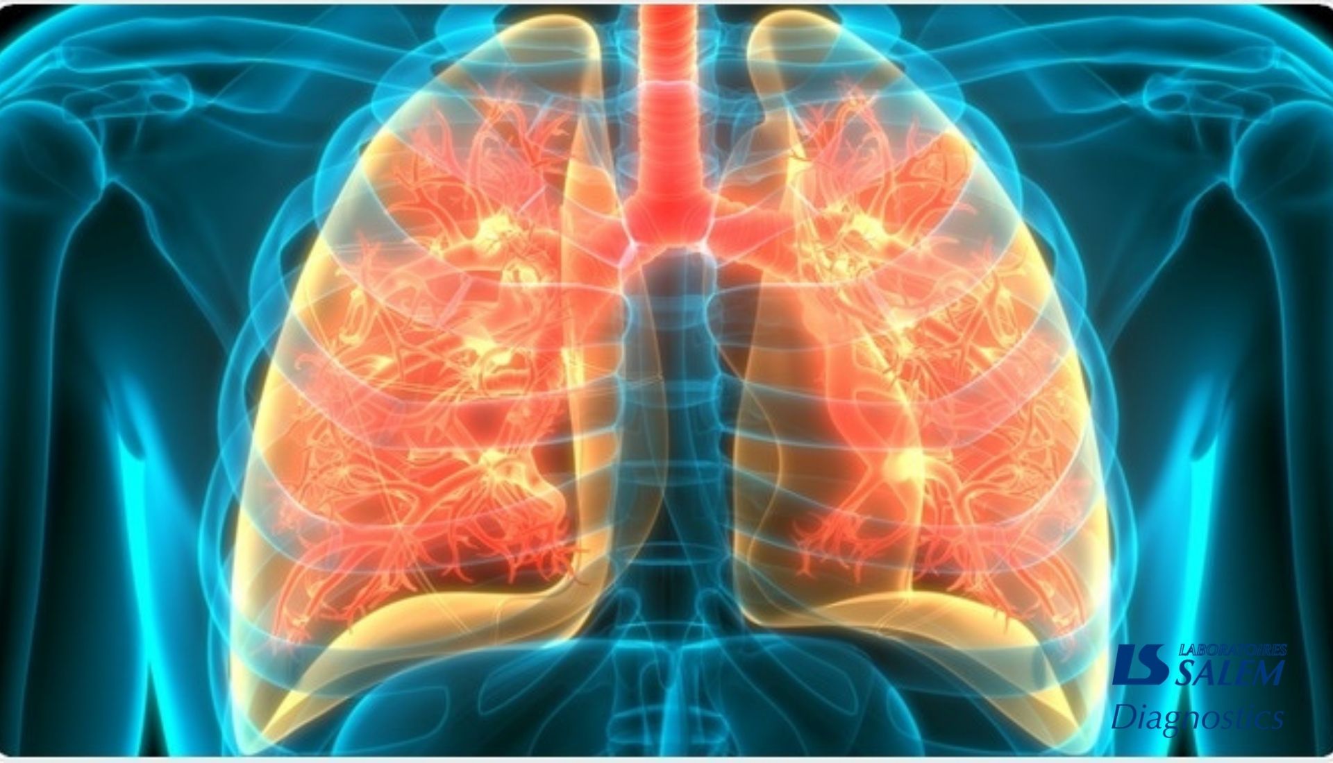 Complications et traitement de la pneumonie | SALEM Diagnostics