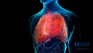 Lire la suite à propos de l’article L’impact des maladies respiratoires chez les patients diabétiques